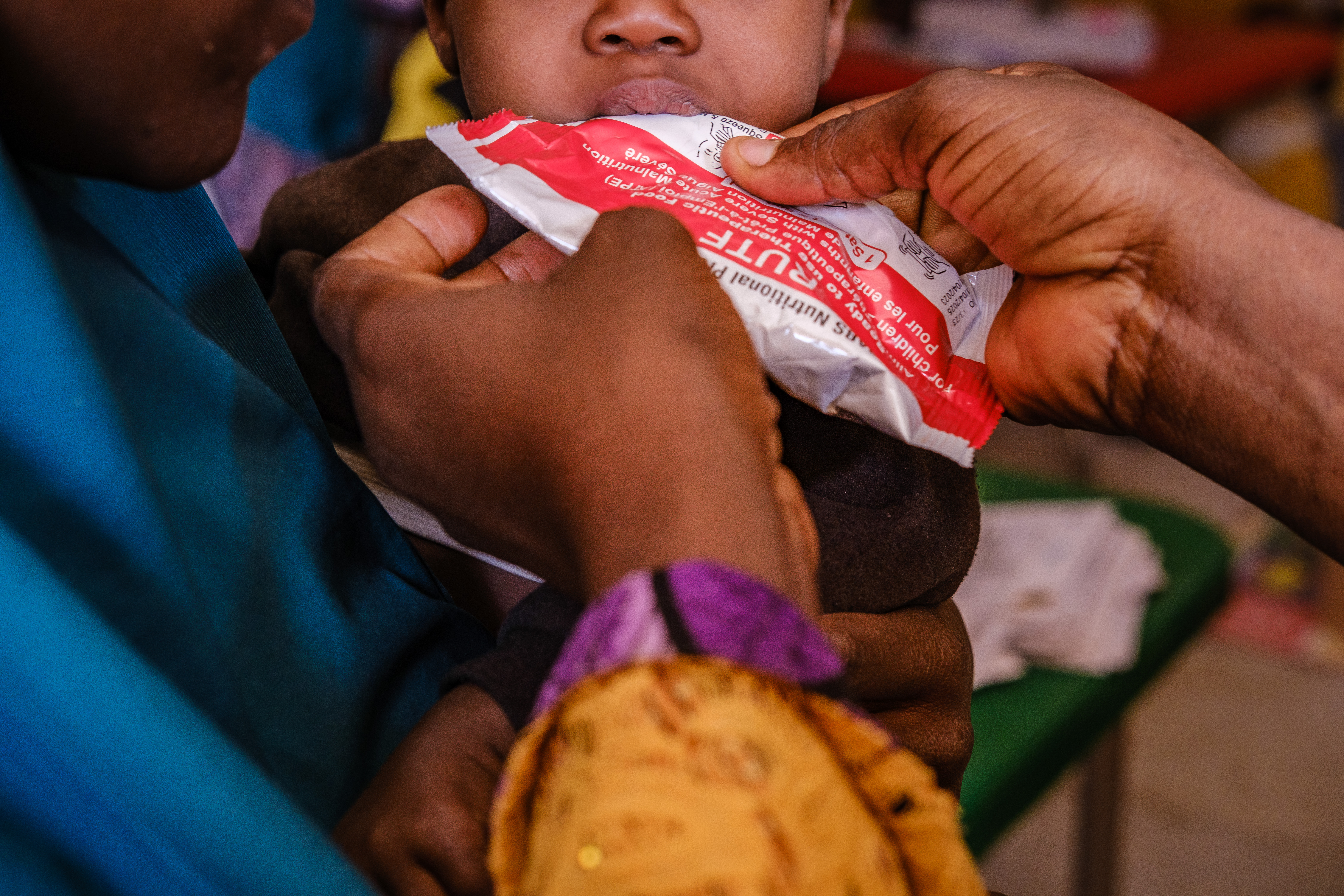 A child receives ready-to-use therapeutic food (RUTF) in Maiduguri to support recovery from malnutrition.